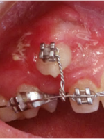 Picture1